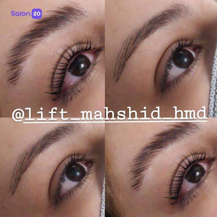 نمونه کار مهشید سمواتی (متخصص لیفت ابرو) 1