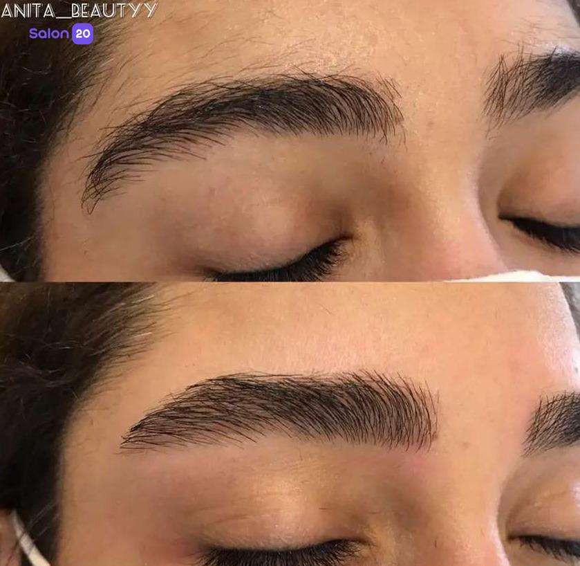 عکس شماره 7 از خدمات زیبایی سالن زیبایی آنیتا