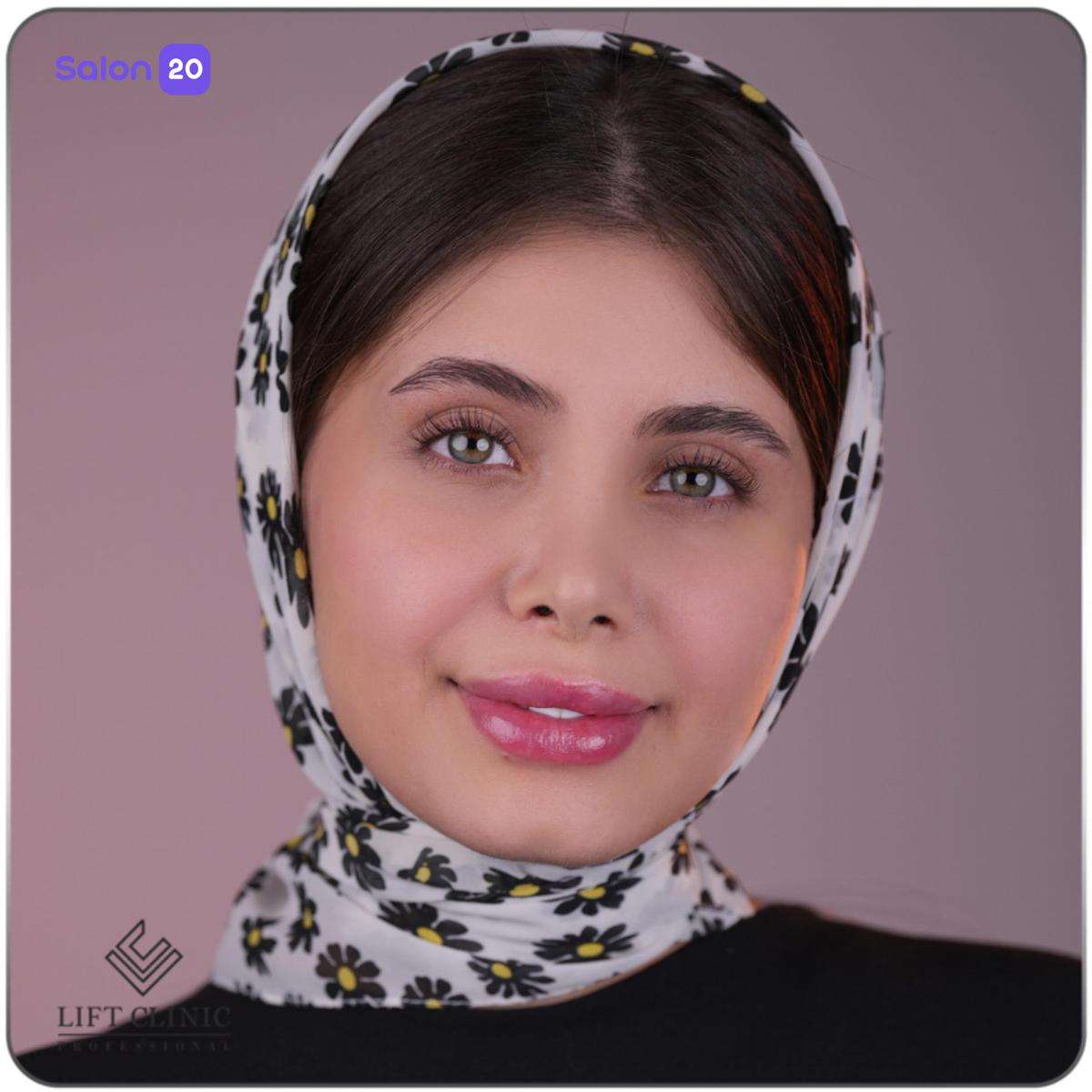 تصویر 2 نمونه کار سالن زیبایی ساراحکیم در تهران، شهرک غرب