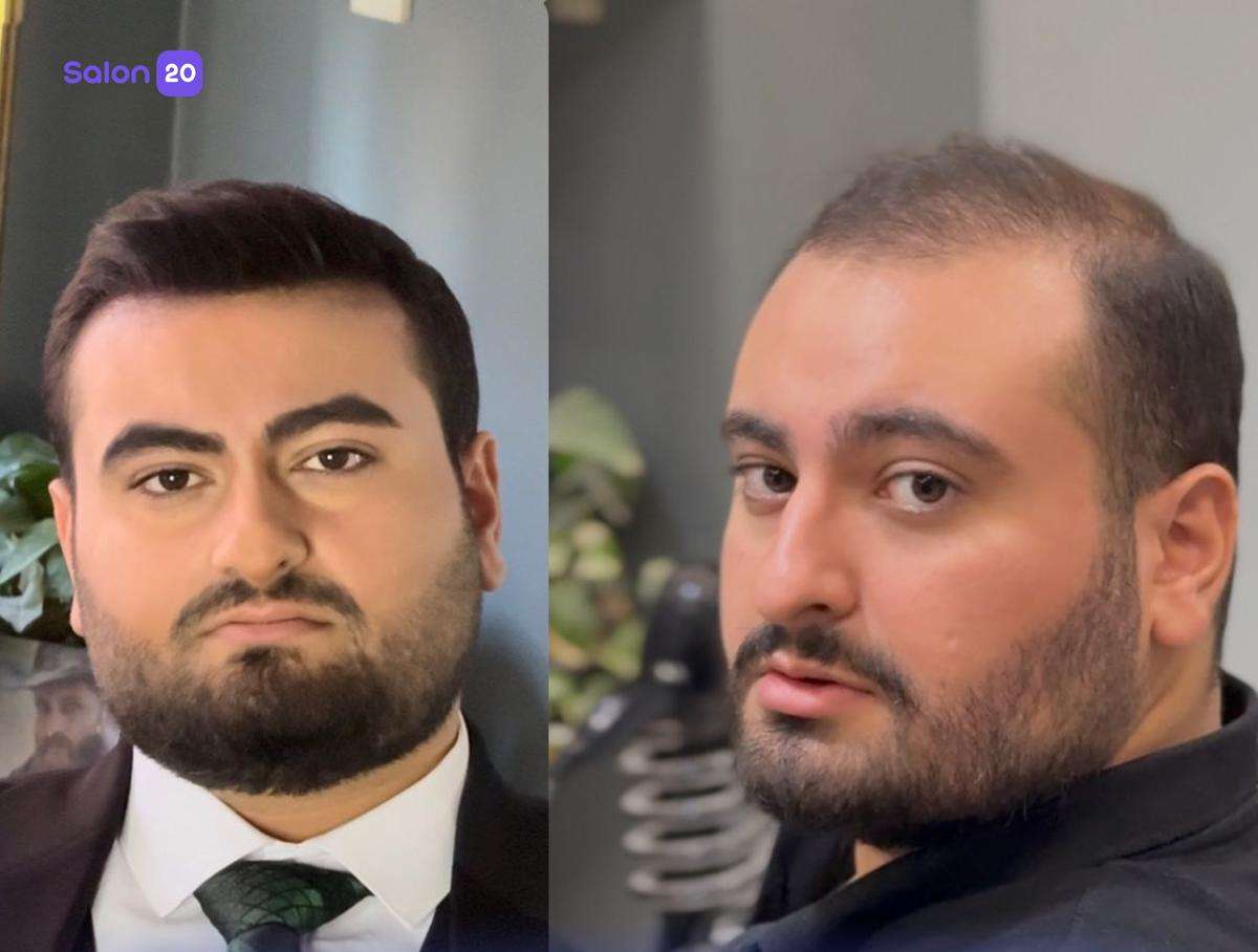 تصویر 8 نمونه کار آرایشگاه امیر اسعدی  در تهران، 