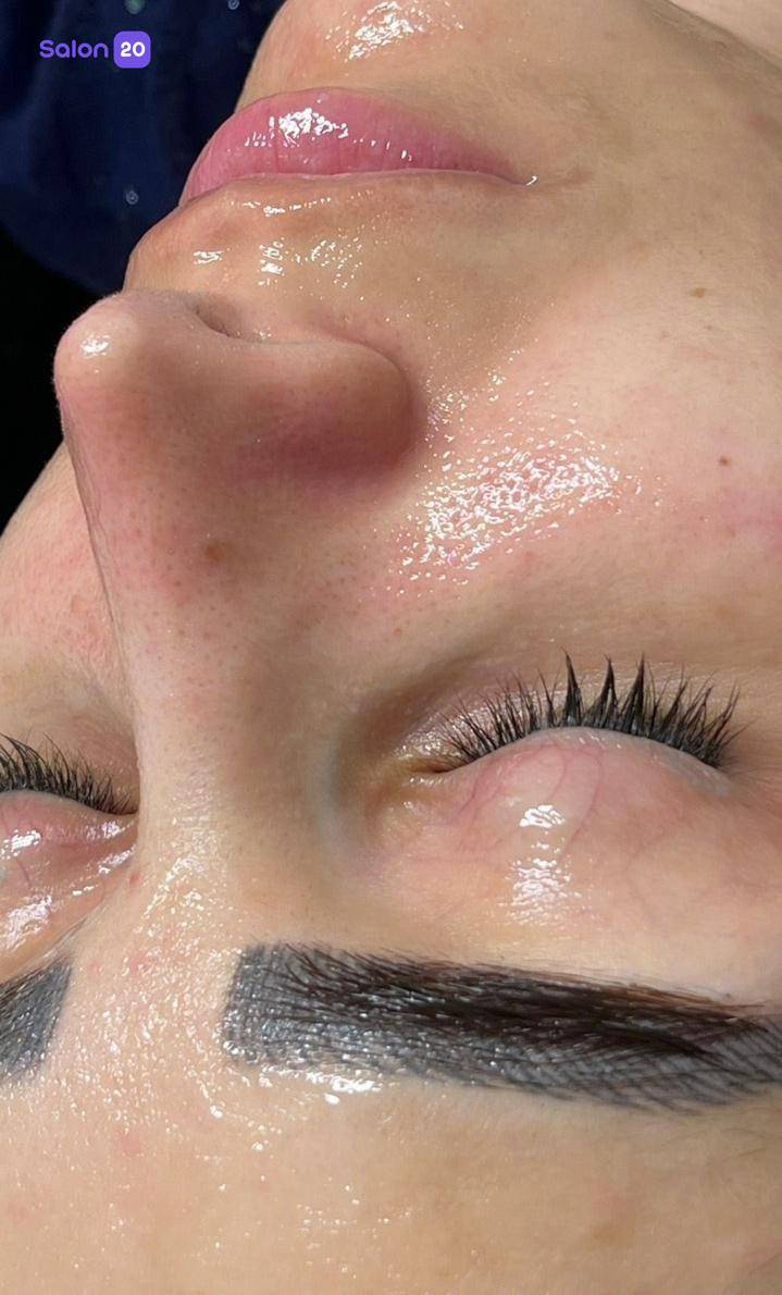 نمونه کار ریحانه (متخصص پاکسازی پوست) 3