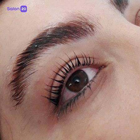 نمونه کار مهشید سمواتی (متخصص لیفت ابرو) 3