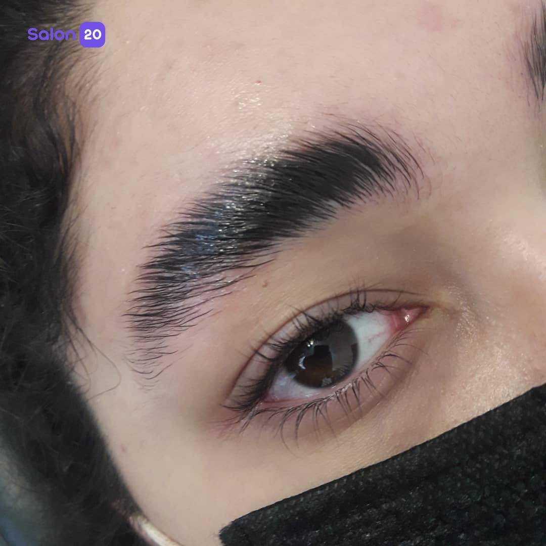 نمونه کار مهشید سمواتی (متخصص لیفت ابرو) 2