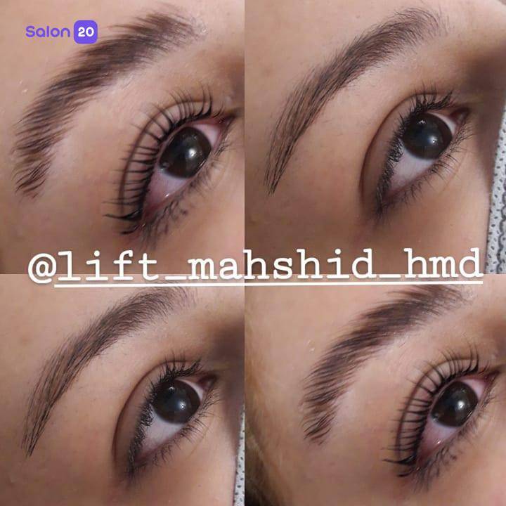 نمونه کار مهشید سمواتی (متخصص لیفت ابرو) 1