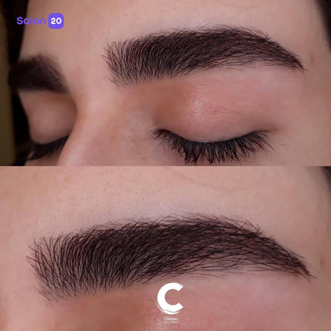 برترین لیفت ابرو نزدیک به هدیش مال