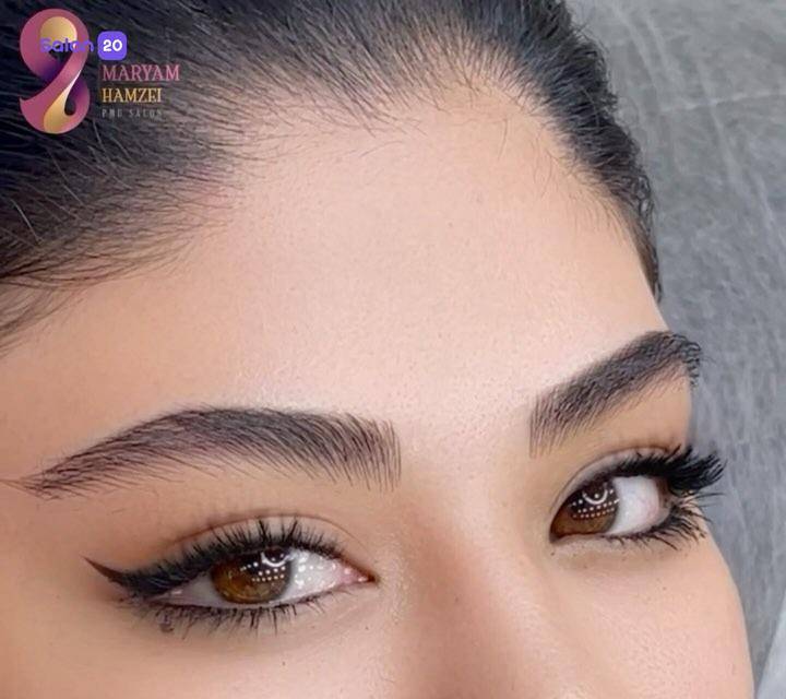 برترین بن مژه شهرک غرب