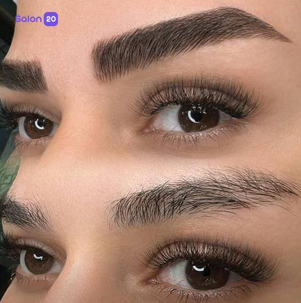 برترین بن مژه کوهسار