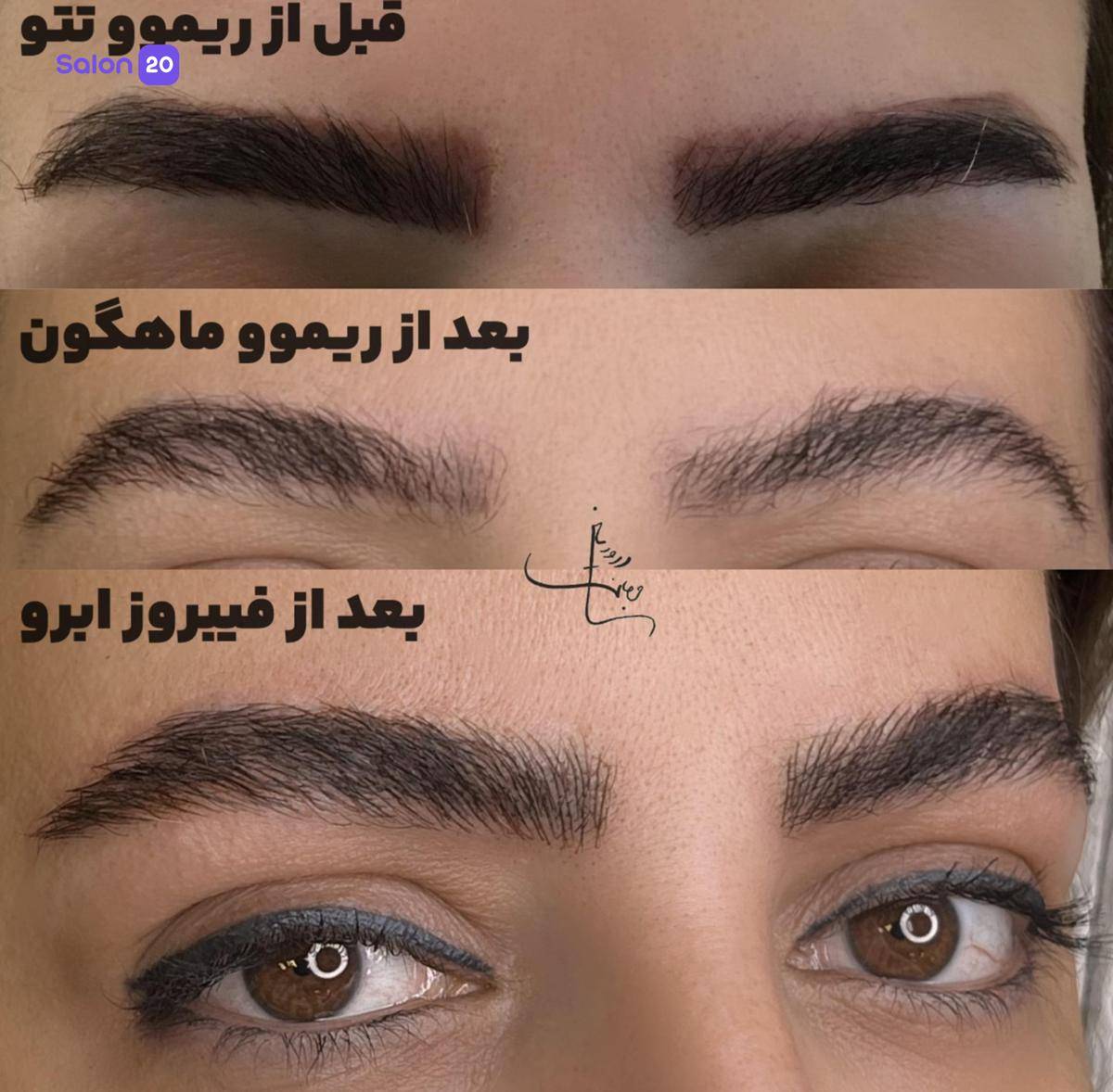 برترین لیفت ابرو نزدیک به بلوار نبرد