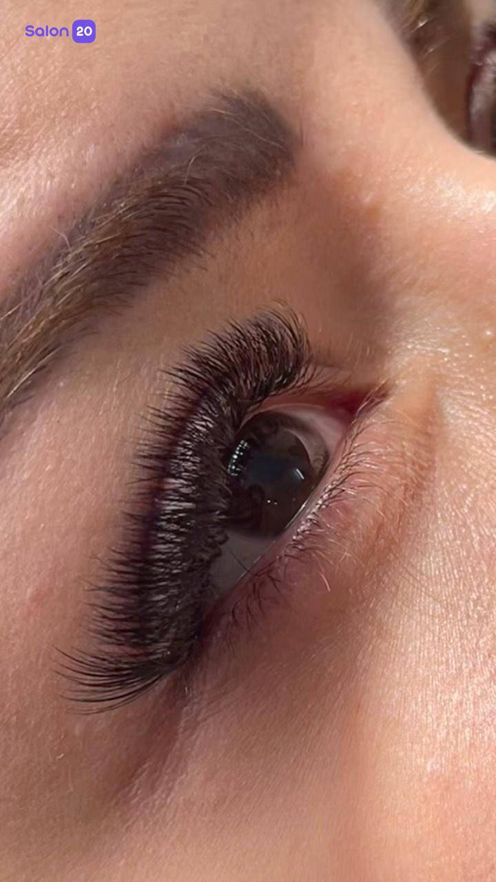 برترین کاشت مژه زرکش