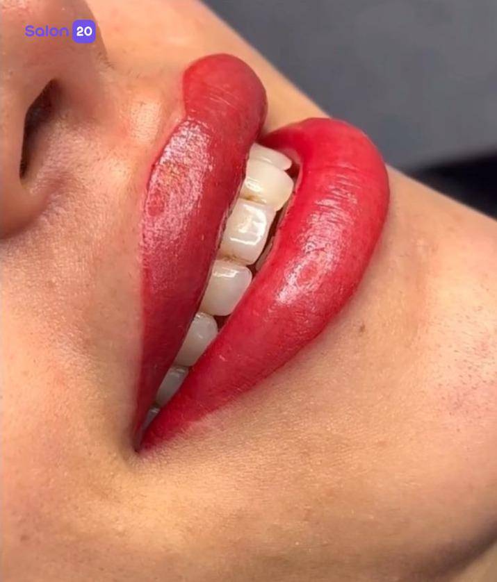 برترین بن مژه پامنار