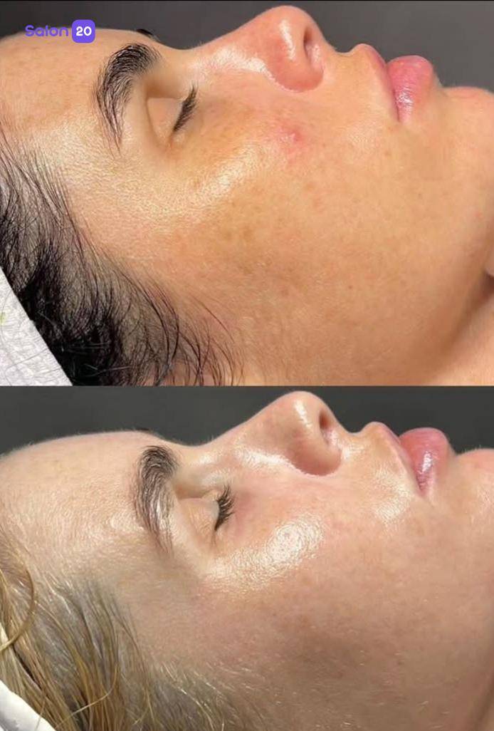 برترین پاکسازی پوست (facial) نزدیک به میدان آرژانتین