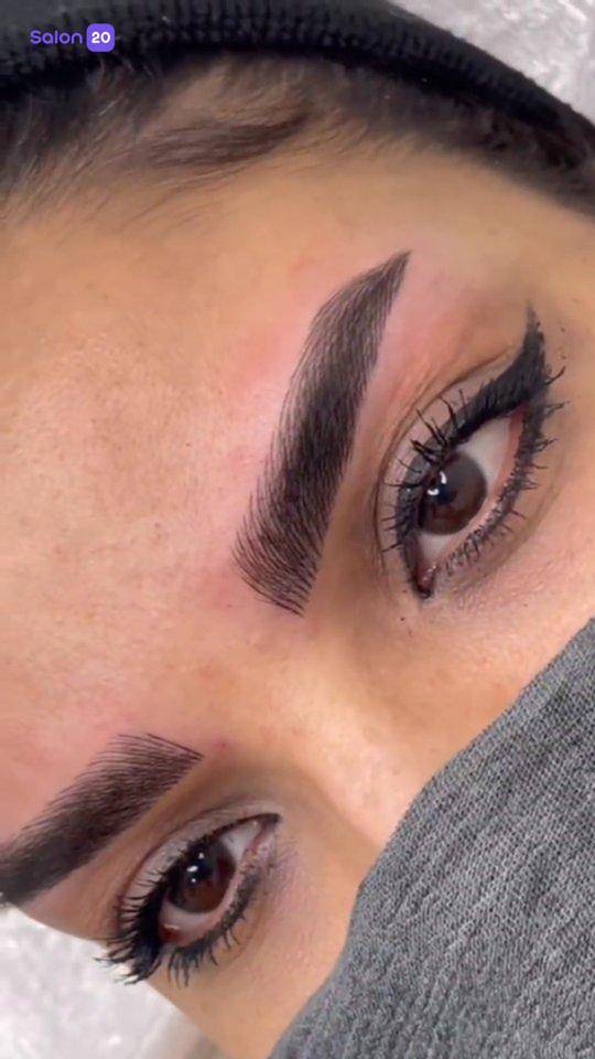 برترین بن مژه شهر زیبا