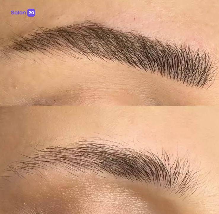 برترین بن مژه قاسم آباد