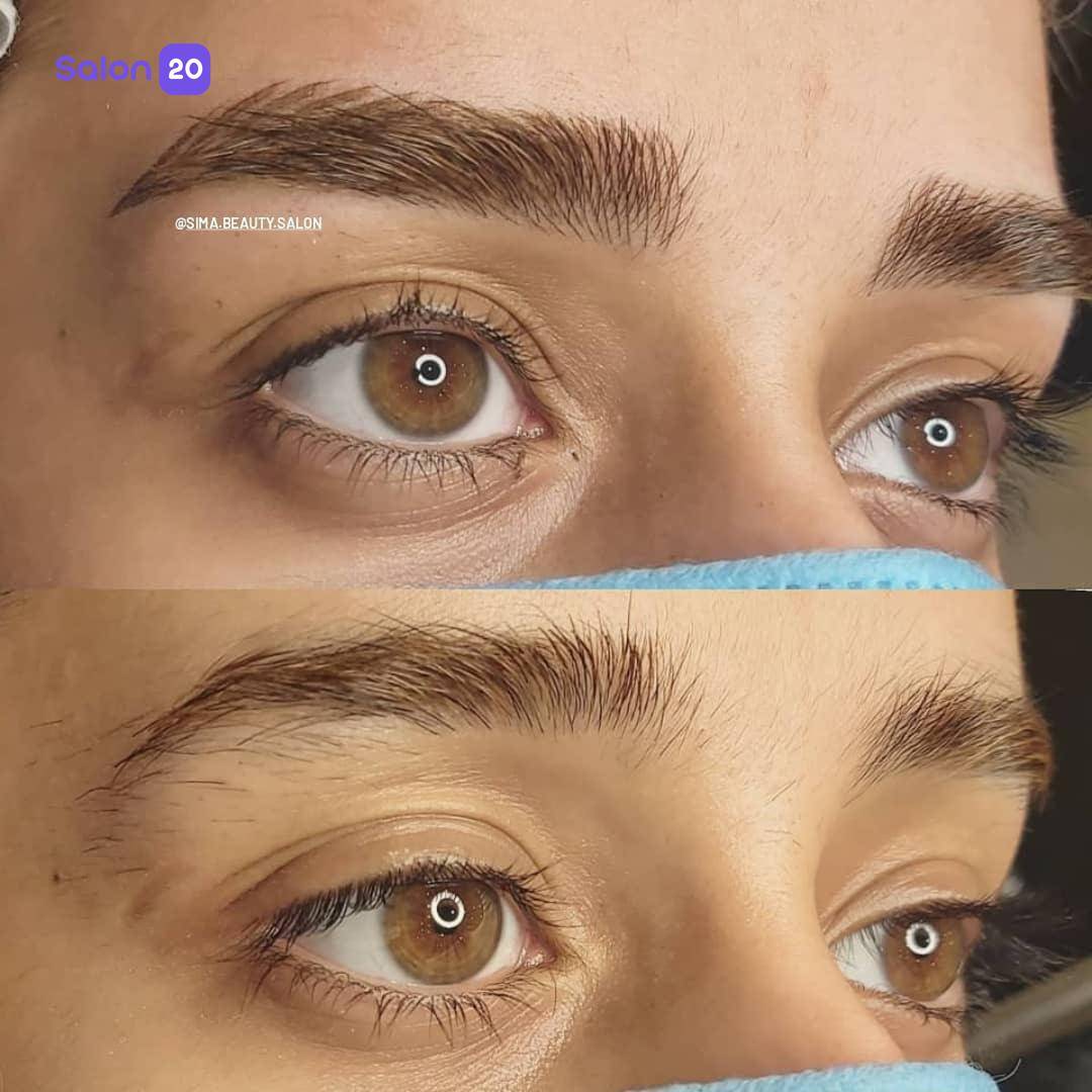 برترین بن مژه سلسبیل جنوبی