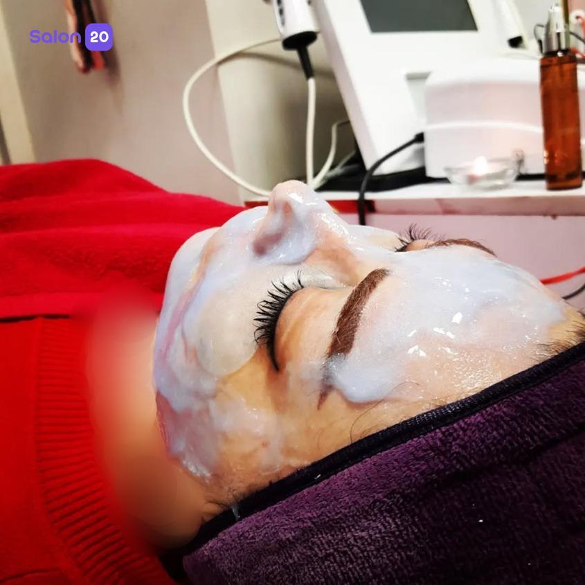 تصویر 5 نمونه کار ازاده قاسمی (متخصص پاکسازی پوست) در تهران، اقدسیه شهرری