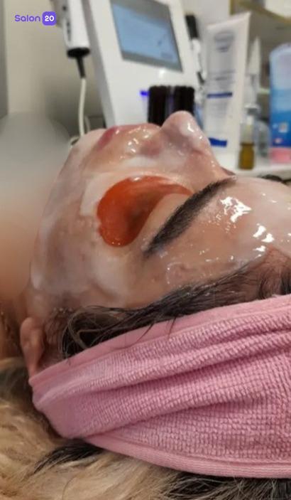 تصویر 7 نمونه کار ازاده قاسمی (متخصص پاکسازی پوست) در تهران، اقدسیه شهرری
