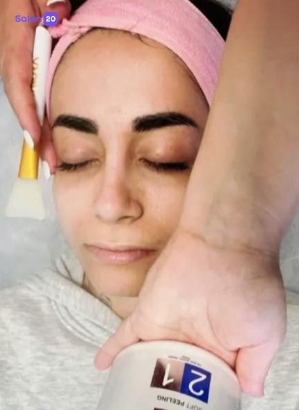 تصویر 3 نمونه کار ازاده قاسمی (متخصص پاکسازی پوست) در تهران، اقدسیه شهرری